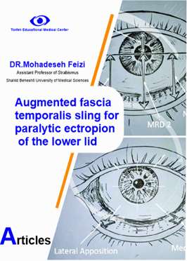 Augmented fascia  temporalis sling for  paralytic ectropion  of the lower lid